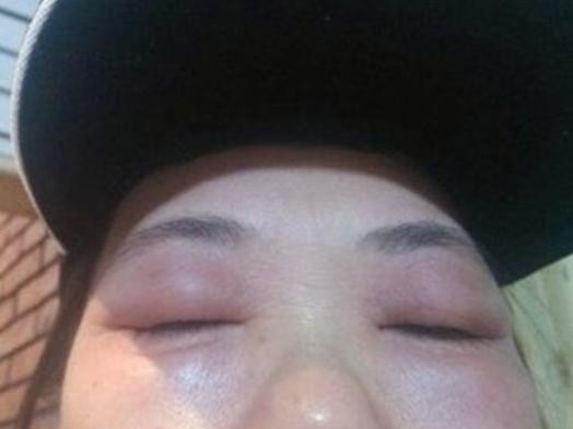 脚肿、腿肿、脸肿、甚至内脏肿，关键你知道这些都代表什么病吗？