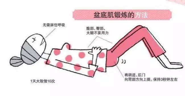 生完小孩一年打个喷嚏就漏尿,打个喷嚏漏尿需要做盆底肌修复吗