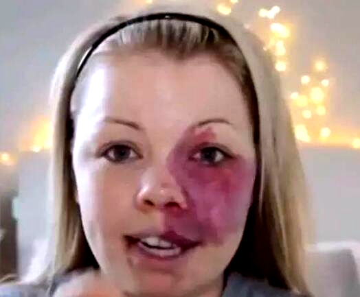 鑴镐笂鏈夎儙璁扮殑濂冲鍖栧褰╃粯,缁欎竴涓弧鑴歌儙璁扮殑濂冲鍖栧