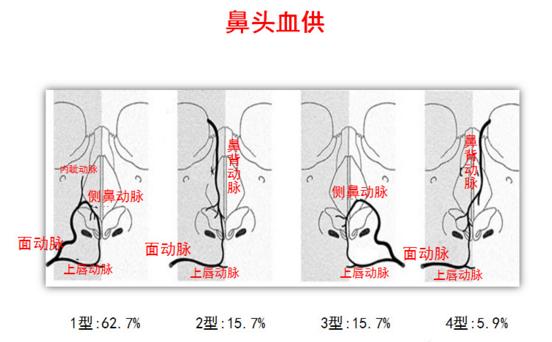 面部注射后血管栓塞图,面部注射栓塞的视频