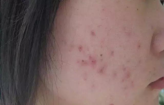 护肤品含香精对皮肤有什么危害,护肤品含汞对人体的危害