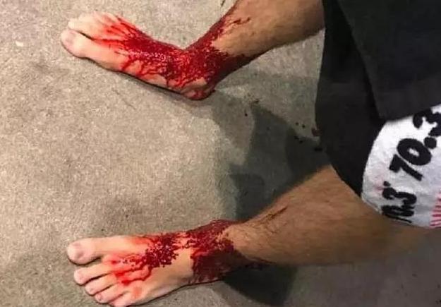 外国小哥脚上的水泡被踩烂,外国小哥下河洗脚摔进去了