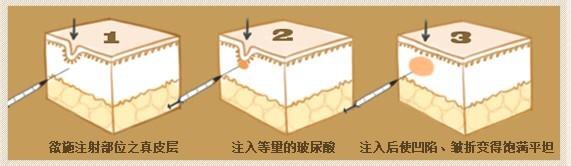 鸭子都变成了“玻尿酸”鸭，你还在怕啥？