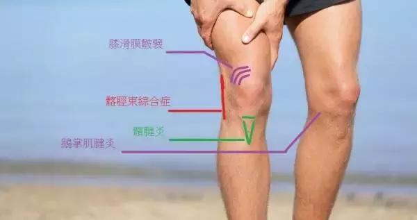 膝关节疼痛的22种疾病,膝关节疼痛警惕四种病35岁