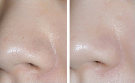 黑头导出液哪个牌子好,好用的黑头导出液推荐