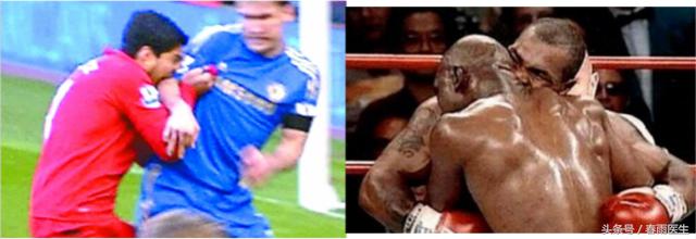 被狗咬了打狂犬疫苗打一针可以吗,被狗咬了打狂犬疫苗