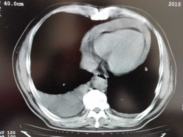 脚肿、腿肿、脸肿、甚至内脏肿，关键你知道这些都代表什么病吗？