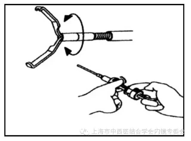 消化内镜仪器操作,消化内镜护理操作名称