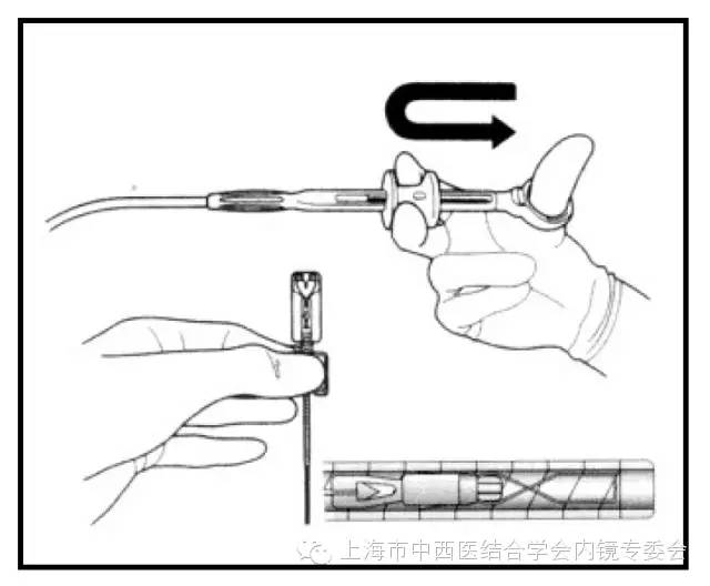 消化内镜护理配合教学视频,消化内镜取样钳