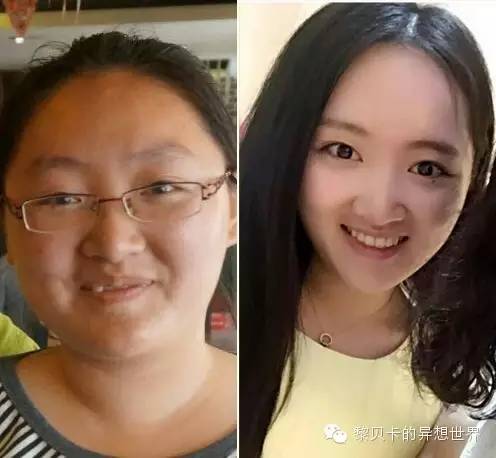 她们说||那些年整牙吞下的血和泪,终于换来最开怀的大笑