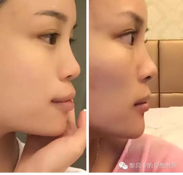 她们说||那些年整牙吞下的血和泪,终于换来最开怀的大笑