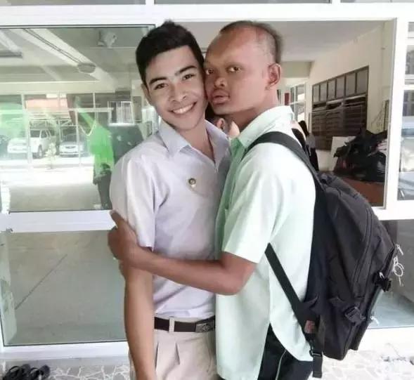 长得丑整容蜕变,长得特别丑整容成功