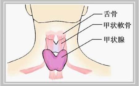 体检甲状腺有结节怎么消除,甲状腺肿大后有没有保守治疗方法