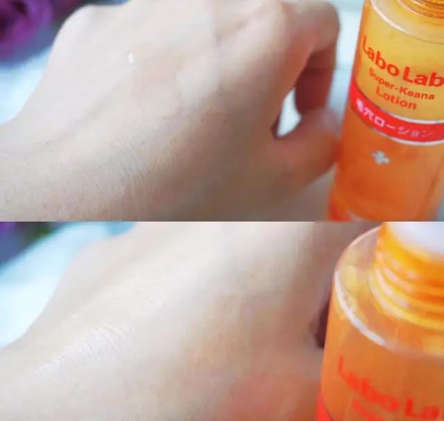 城野医生收敛水为什么凉凉的,城野医生收敛水有消炎祛痘作用吗