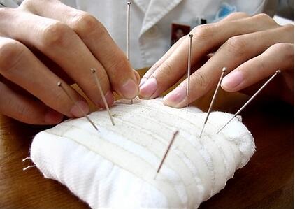 针灸注意事项和禁忌，这些人一定别针灸！