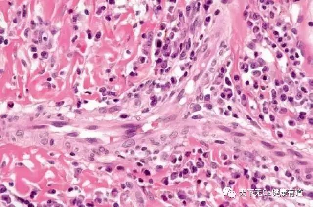 怎么判断升白针是否有效,升白针都有哪种