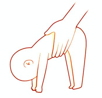 2018中国脑卒中康复治疗指南,脑性瘫痪最佳物理疗法