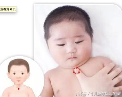 小儿推拿脾胃调理吴医生,小儿推拿全真精品教学