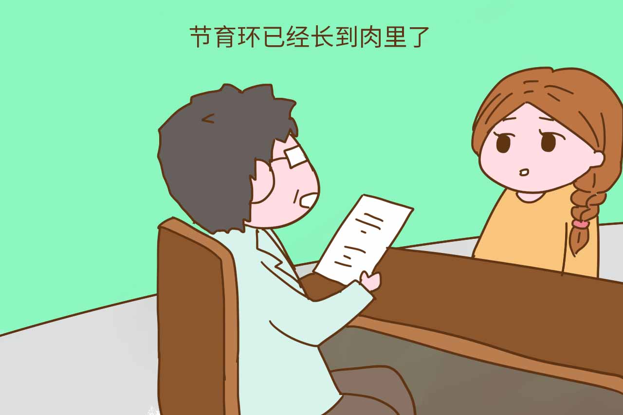 节育环长肉里了要不要取出来,节育环会掉入宫底吗