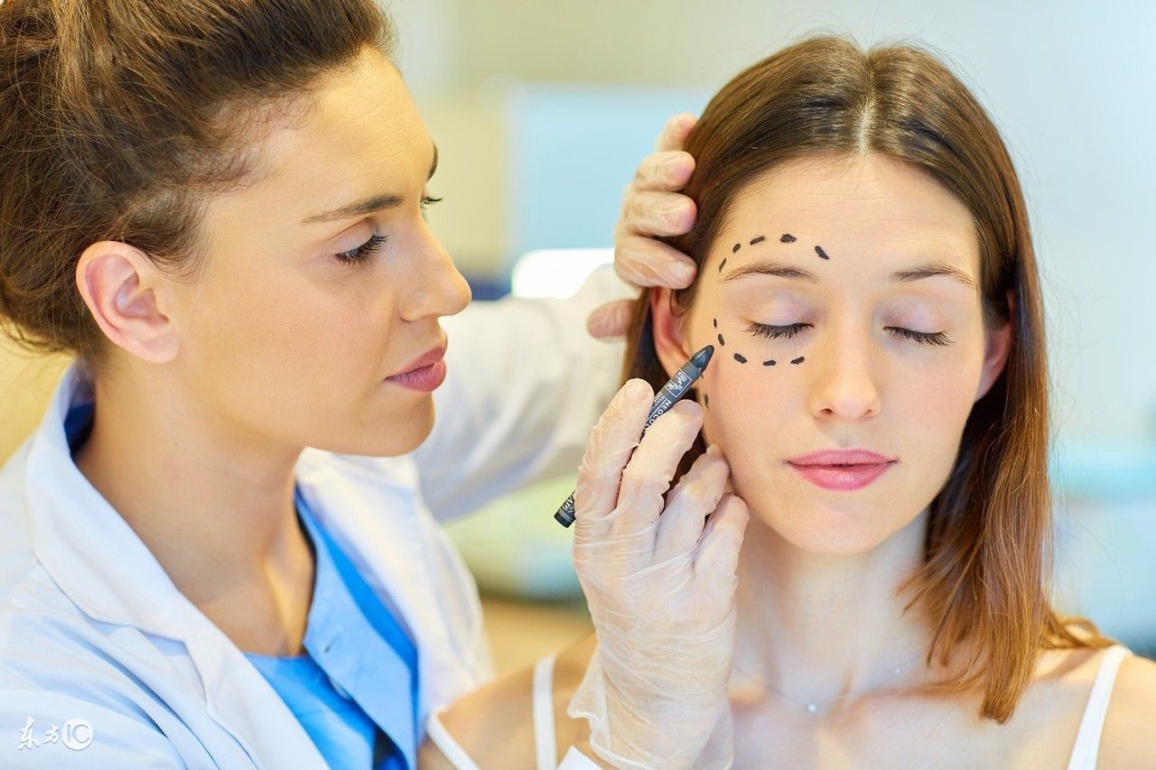 双眼皮手术后悔的经历,双眼皮手术花了一万八