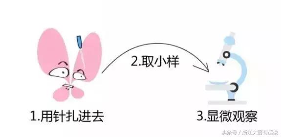 甲状腺结节是什么病,甲状腺结节是什么