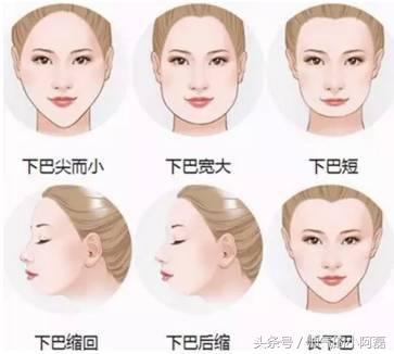 玻尿酸微整形丰下巴多少钱一针,下巴微整形要多少钱