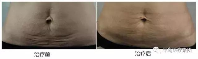 准妈妈要知道的孕期知识,准妈妈孕期常识科普节目