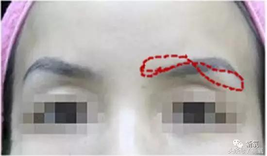 杨紫微整前后容颜对比,杨紫瘦了吗