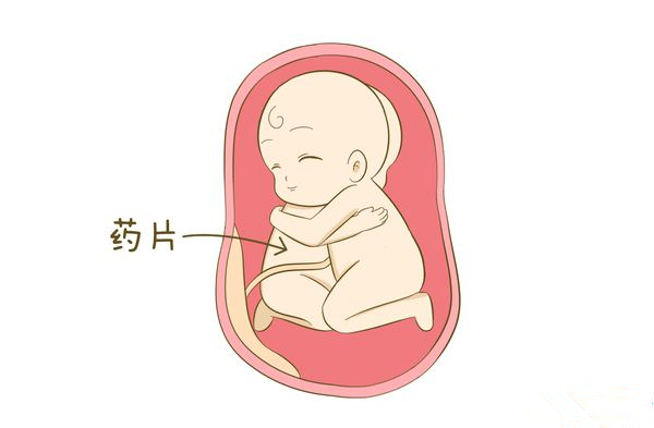 预产期40周到了还没生怎么办,孕40周不发动催产还是继续等待