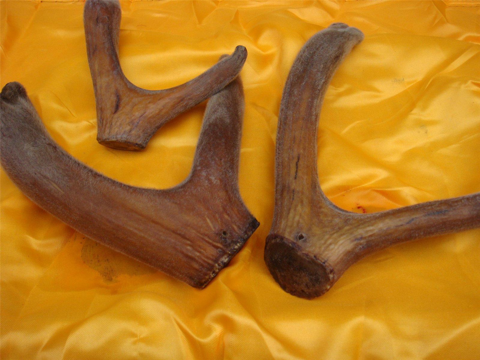 手上扎根刺20多天了,手里扎刺会自愈吗