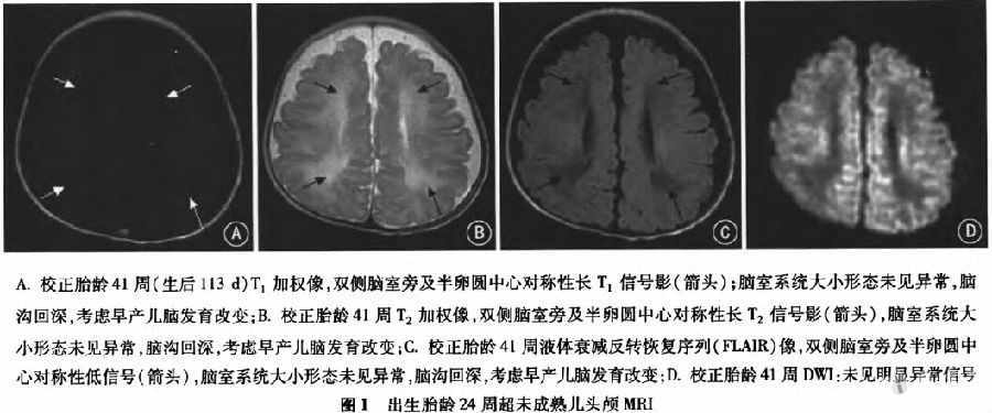 超早早产儿病例,超早早产儿病例讨论