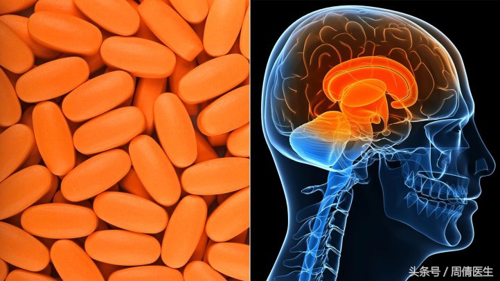 帕金森脑深部电刺激效果,脑深部电刺激dbs美国