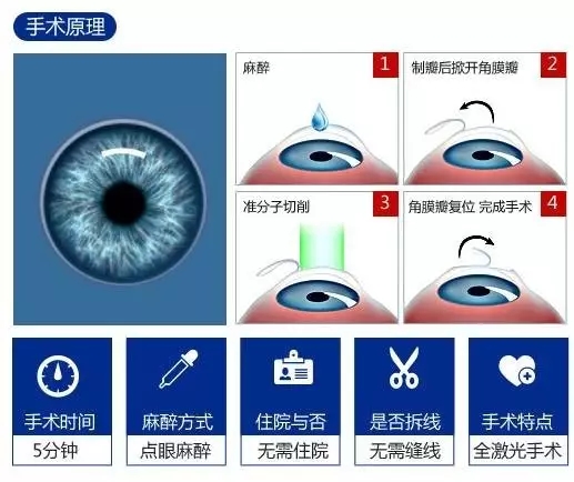18岁眼睛近视1000度可以做手术吗,近视1000度散光400度可以做手术吗