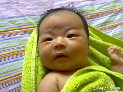 婴儿有黄疸是不是说明他肤色很黄,黄疸数值正常了宝宝脸还是很黄