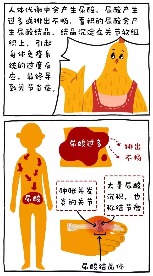 吃海鲜喝啤酒真的会得痛风吗,吃海鲜喝啤酒怎么预防痛风发作