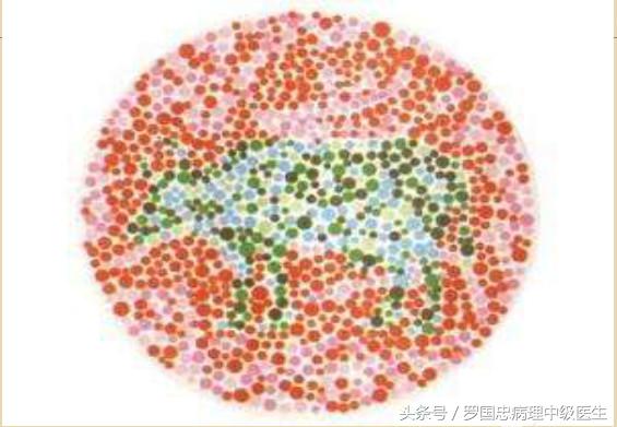 有方法纠正色盲色弱吗,色盲色弱测试诀窍讲解