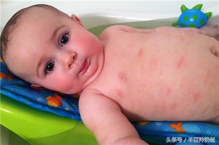 宝宝吃猕猴桃过敏怎么消除,猕猴桃过敏的人还对什么过敏