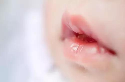 月嫂总结那些事：新生儿这28种情况是正常的