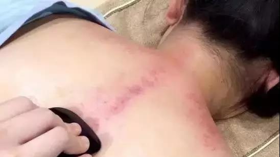 中年女人肩颈衰老怎么办,缓解肩颈衰老的方法