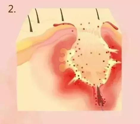 啊！没错，我今天要拯救你们的脸于水火之中！