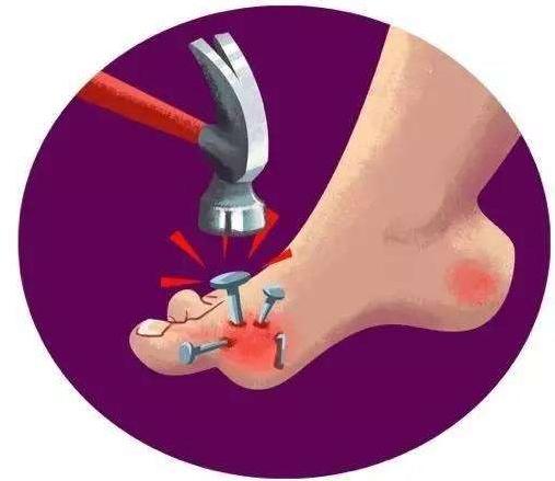 警惕痛风的8个误区,痛风患者需要避免的三个误区