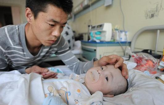 两岁孩子脑损伤的10大症状,因为自己的大意给孩子脑损伤