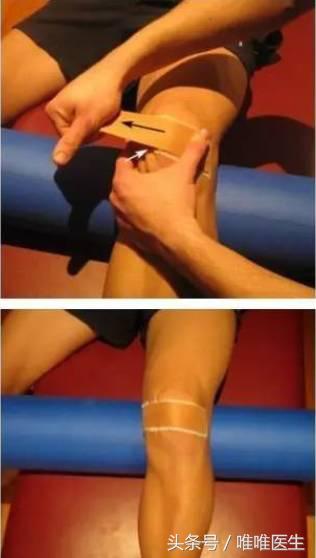 膝前左侧疼痛,膝前痛康复训练