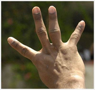 伟大的象征：孙杨的指纹、郭晶晶的眼睛、詹姆斯的脚趾、科比的手