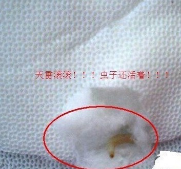 卫生巾要不要经常换,如果卫生巾过了很久没换会怎么样