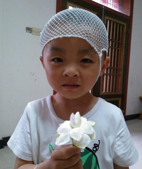 宝宝头上长了一个疤子怎么回事呢,宝宝头上有个疤越长越大怎么办