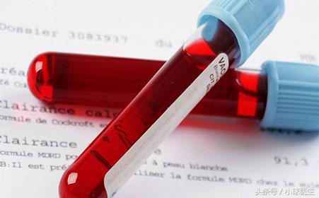 透析了,就不要再管肌酐高低了?!