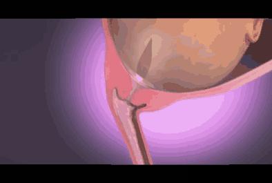 胎儿入盆及分娩过程模拟,怀胎十月分娩