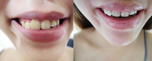 家里有小苏打能做什么实验,平时家里常见可食用的小苏打