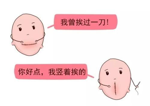 疤痕子宫再妊娠需要注意什么？还有机会顺产吗？